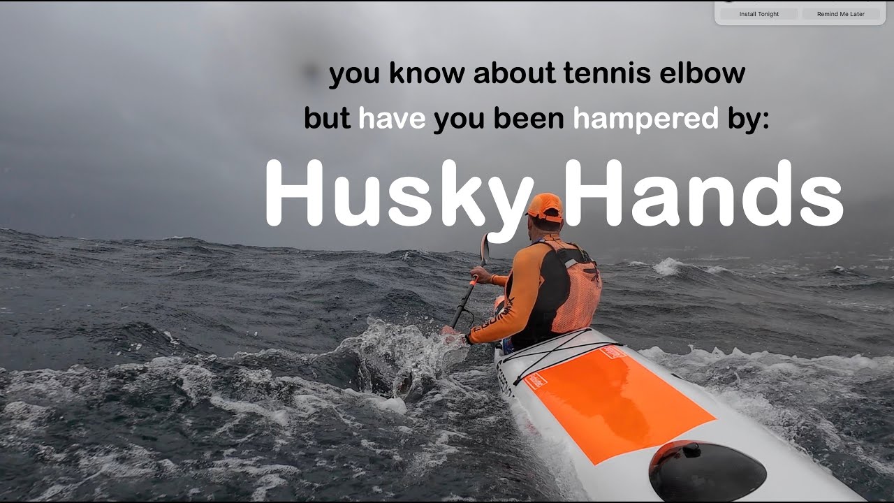 SURFSKI: Have you had HUSKY HANDS ?