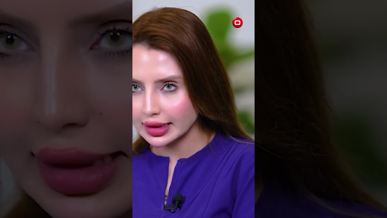 فيديو | اسباب فقر الدم عند النساء #shorts