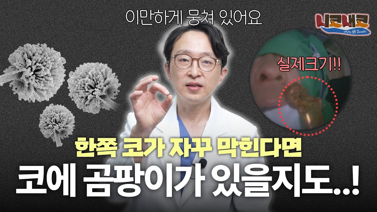일반적이지 않은 축농증, 진균성축농증ㅣ👃🏻니코내코 EP.22