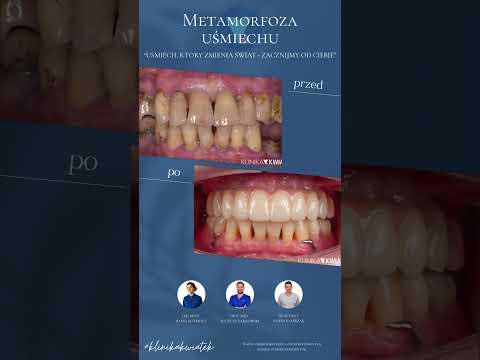 Mateusz Tarnowski-5