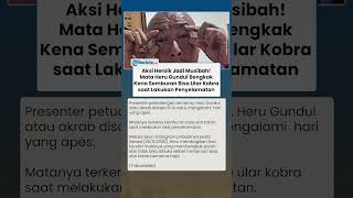 Heru Gundul Alami Insiden saat Evakuasi Ular, Mata Bengkak Kena Semburan Bisa Kobra