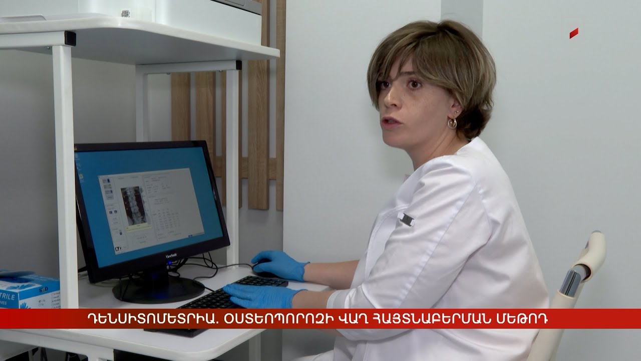 Դենսիտոմետրիա. օստեոպորոզի վաղ հայտնաբերման մեթոդ