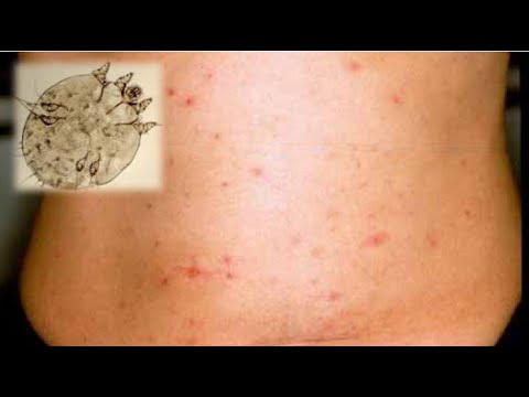 風に強い植物 起源 野生の疥癬が激しく広がる 花 7月 9月