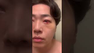 #kpopdance #くまとり #美容整形