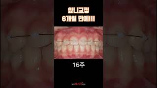 [스타브랜드] 수준 높은 진료서비스 상무스타치과병원