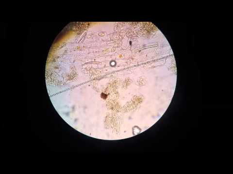 Pond Scum under a Microscope