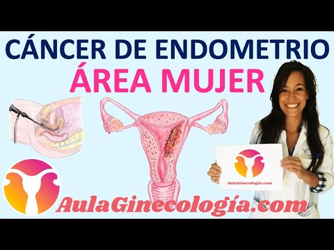 Endometrial Cancer: Causes, Symptoms, Treatment, Follow-up... - Gynecology and Obstetrics -