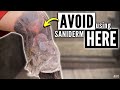 Warning: Avoid These Areas When Using Saniderm & USE This EASY Method to Remove Second Skin