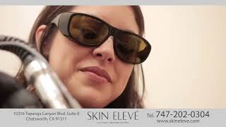 Skin Eleve