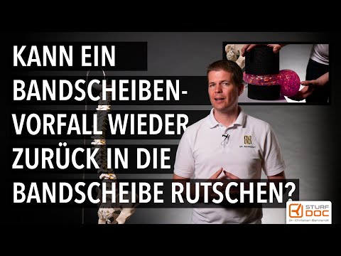 Kann ein Bandscheibenvorfall wieder zurück in die Bandscheibe rutschen? - In drei Minuten erklärt