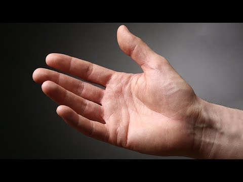 Articulația și mâinile rănite