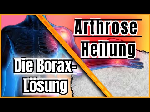 BORAX, die Lösung und Heilung bei Arthrose, Osteoporose, Arthritis!?