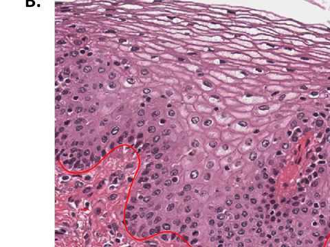 Lab Review of Epithelial Tissue and Histology
