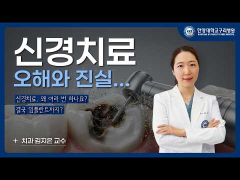 근관치료(신경치료), 이것만 알면 됩니다 - 과정부터 자주 묻는 질문까지