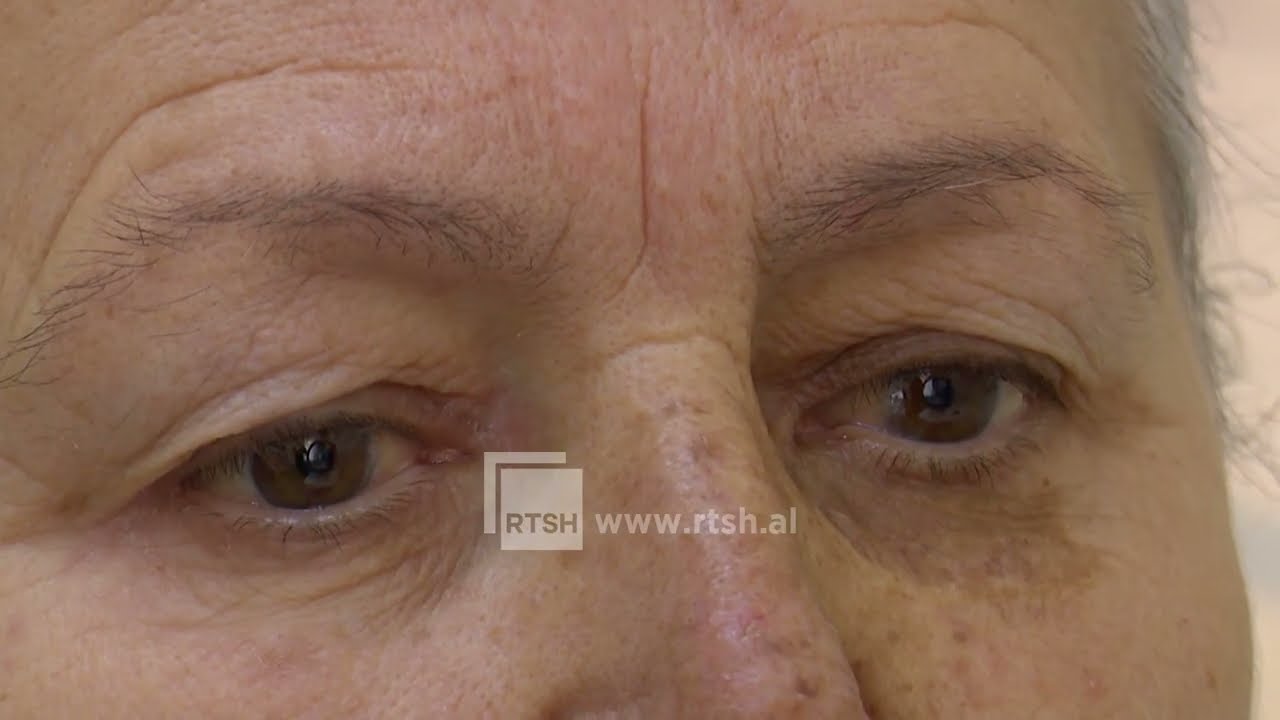 Retinopatia, mjekët apel për kontroll të sheqerit në gjak dhe vizita te okulisti një herë në vit