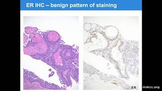 Download Lagu 2018 MSK Alumni Conference - Dara Ross MD - Case Study 5 Thumbnail