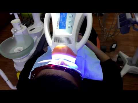 Plastic COXO C Bright Teeth Whitening Accelerator, For Commercial