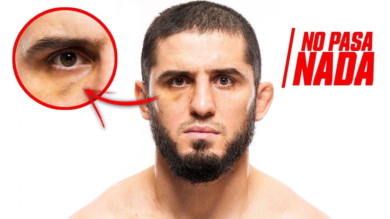 ¡Islam TIENE UN OJO MORADO!