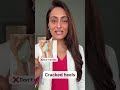 Cracked Heels How To Manage Dermatologist Suggests