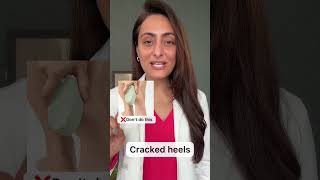 Cracked heels| How to manage | Dermatologist suggests
