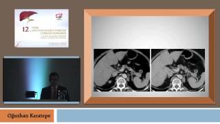 HPB cerrahide perioperatif dönemde Preoperatif görüntüleme nasıl olmalı / Oğuzha