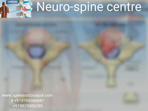 JPRC Neuro Spine Centre - Advanced Minimally Invasive Procedures | Neurosurgeons