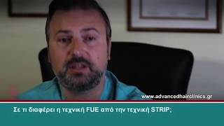 Ανώδυνη Μεταμόσχευση Μαλλιών Advanced FUE (Μέρος 1ο) - Δρ. Αναστάσιος Βεκρής