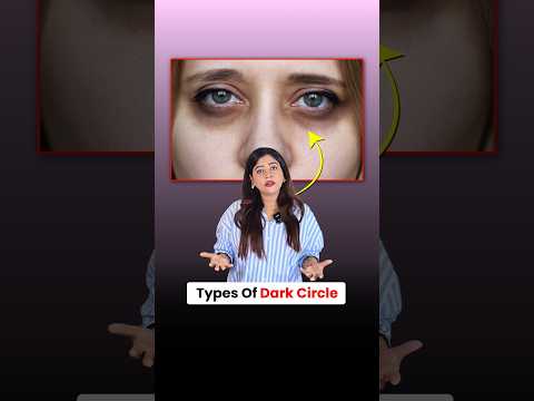 Dark Circles ke 3 Types – Kya Aapko Apna Type Pata Hai? | Dermatologist