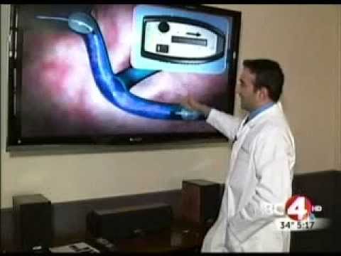 Dr Bhatla discusses the Trellis system for treating Deep Vein Thrombosis