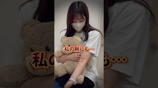 【小児科医が解説!とびひ感染に注意！⚠️】#小児科  #育児あるある #子育て #アクアキッズクリニック#shorts