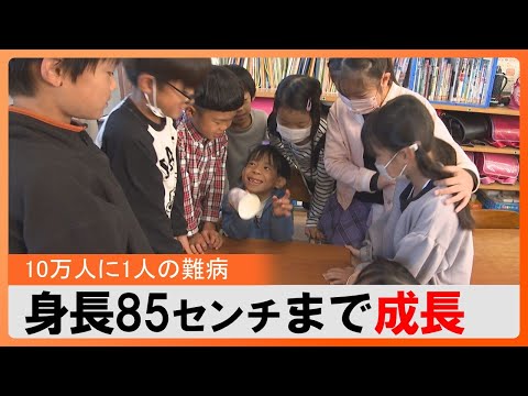 新しい研究によると、背の高い人は背の低い人と病気のかかり方が大きく異なる