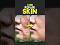 1 Minute Repair Skin In Photoshop Photoshop Shorts Tutorial