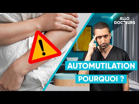 Le Dr Jimmy Mohamed parle d'automutilation - Allo Docteurs