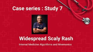 Clinical Case 7 : Widespread Scaly Rash