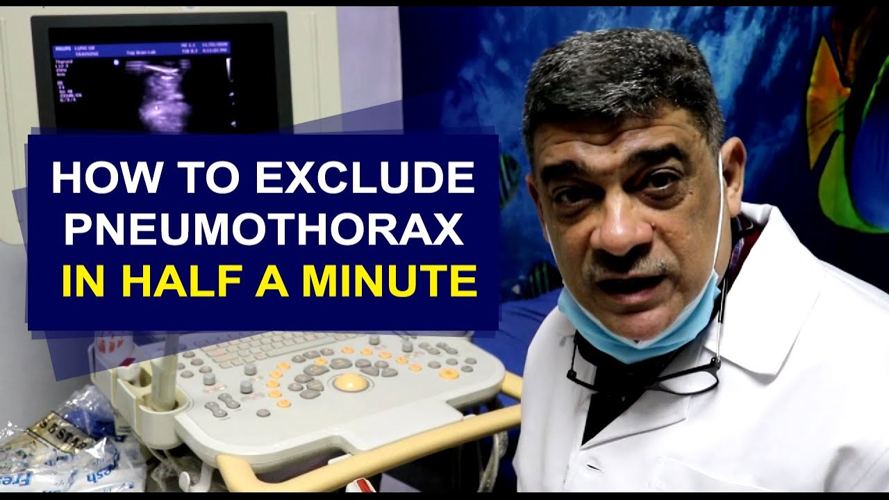 How to exclude pneumothorax in half a minute