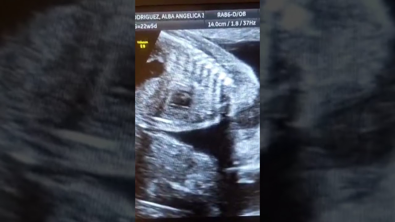 Alfonso Sanchez Rodriguez-98