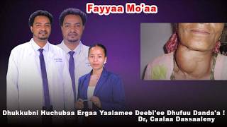 Dhukkubni Huchubaa Ergaa Yaalamee Deebi'ee Dhufuu Danda'a ! Dr, Caalaa Dassaaleny - Fayyaa Mo'aa