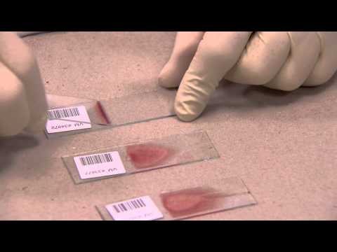 IDEXX - How to make a Blood Film in 3 steps