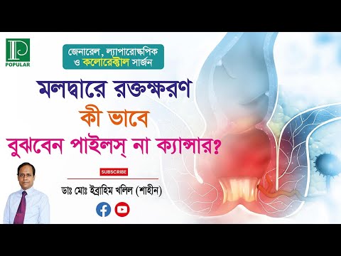 মলদ্বারে রক্তক্ষরণ হলে কিভাবে বুঝবেন এটি পাইলস না ক্যান্সার?