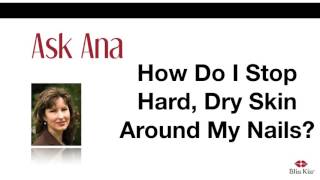 Ask Ana: How Do I Stop Hard, Dry Skin Around My Nails?