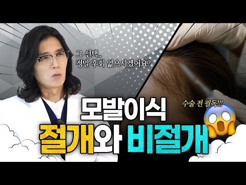 모발이식 방법 비교절개VS비절개 장단점 한눈에ㅣ헤어로의원 전주점ㅣ
