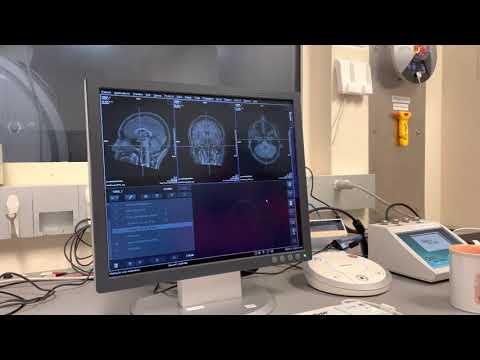 Downloading SVS files