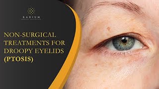 Non-Surgical Treatments For Droopy Eyelids (Ptosis) | Radium Medical Aesthetics