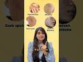 Skincare For Pigmentation And Uneven Skintone Sunscreen For Pigmented Skin Dark Spots Melasma