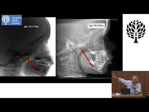 Optimizing Sleep and Breathing Hygiene in Earliest Childhood: Healthspan Implications - Kevin Boyd
