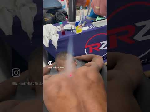 RZ's Mobile Cryotherapy is for everyone of all levels!