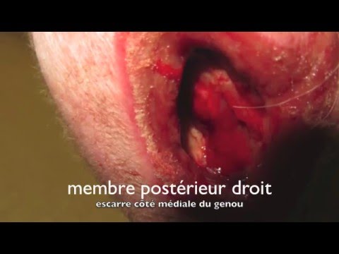 comment traiter une fracture ouverte