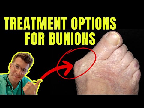Doctor explains BUNION TREATMENT OPTIONS