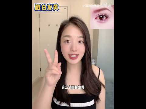 眼睛黑白不分明