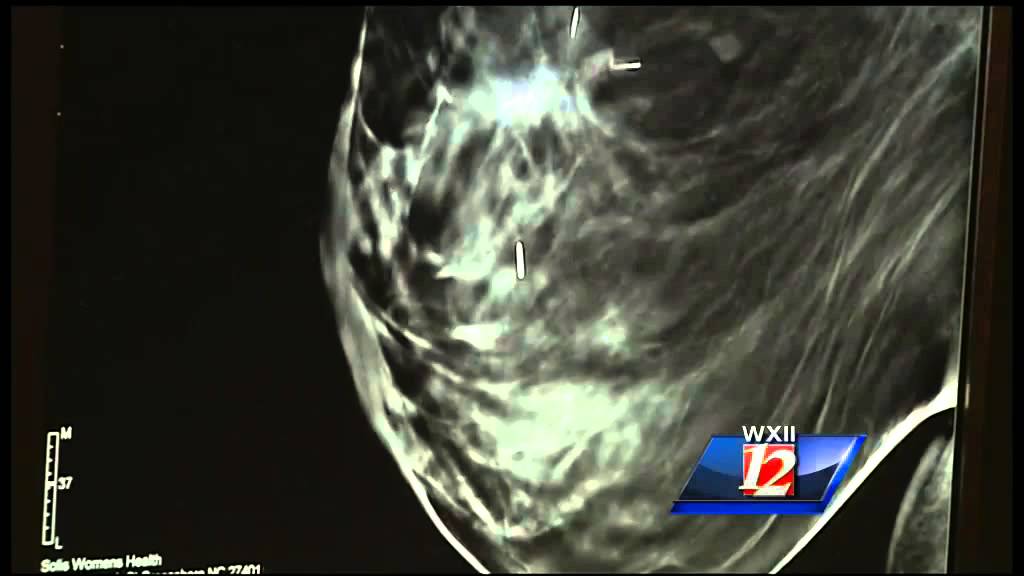 WinstonSalem Piedmont MRI Imaging MRI, CT, Nuclear Medicine, Mammo